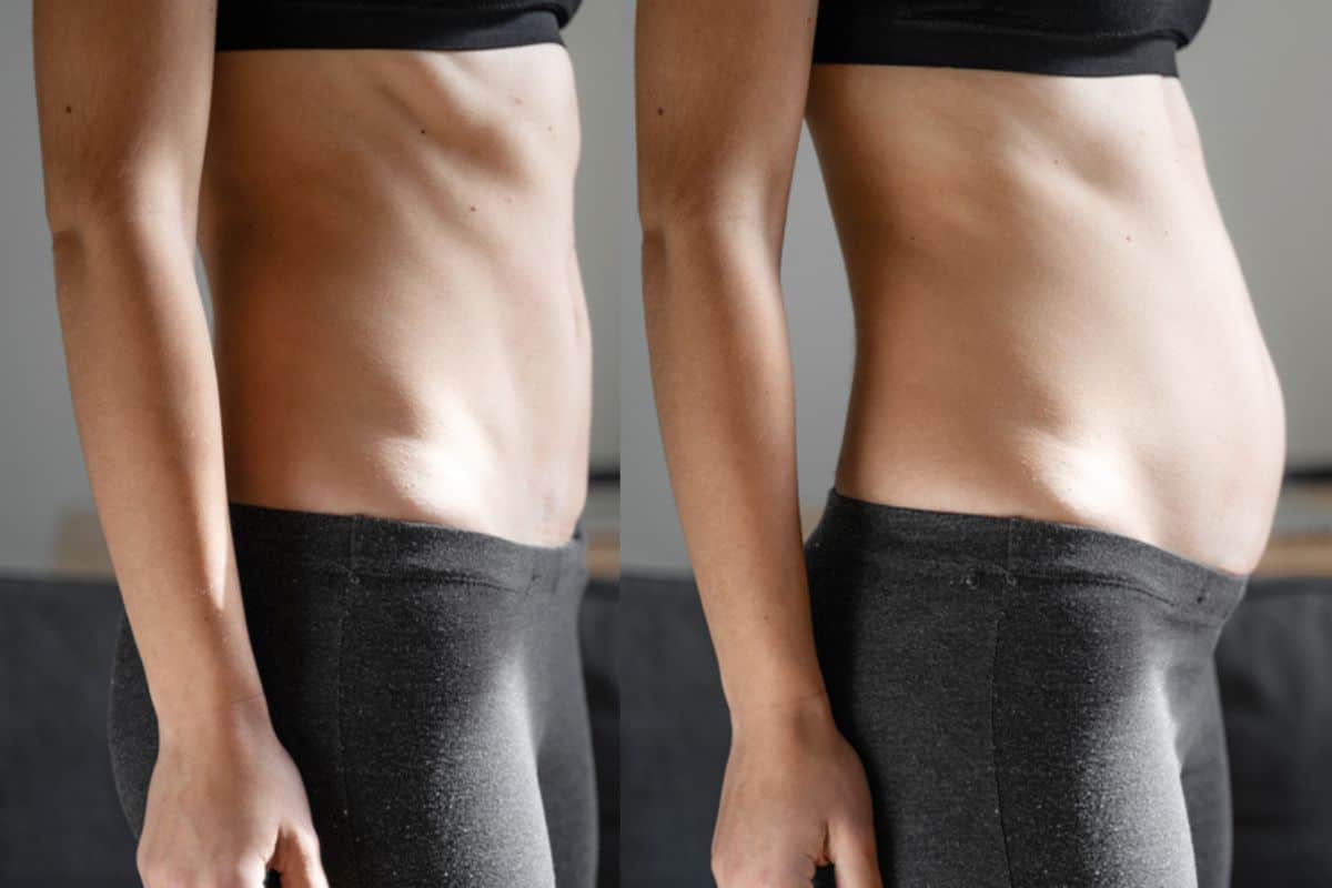 How long does diastasis recti take to improve Sale?