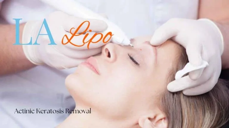 Woman receiving Actinic Keratosis Removal Treatment Sale