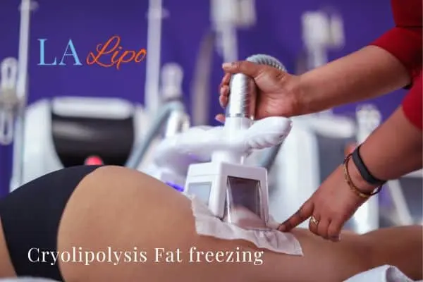 women getting fat freezing Sale