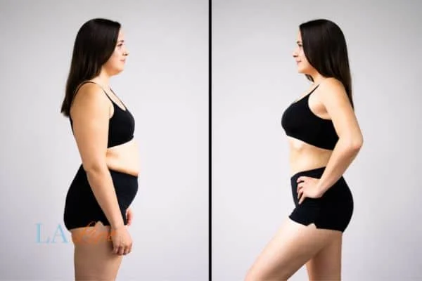 link between body image and mental health Sale