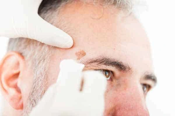 Age spots and elderly people Sale what is the link?