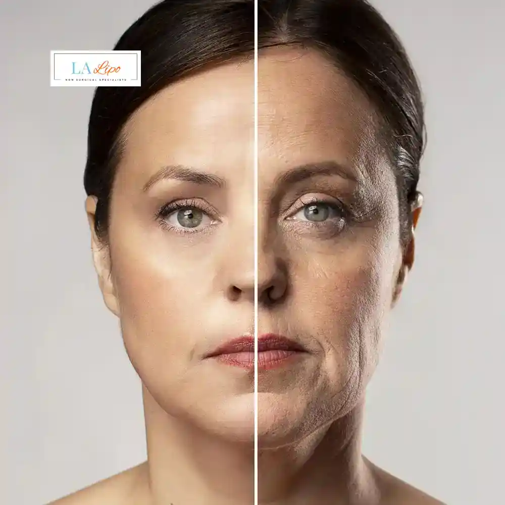 How Can You Tell If Non-Surgical Skin Tightening Is Right for You Sale?