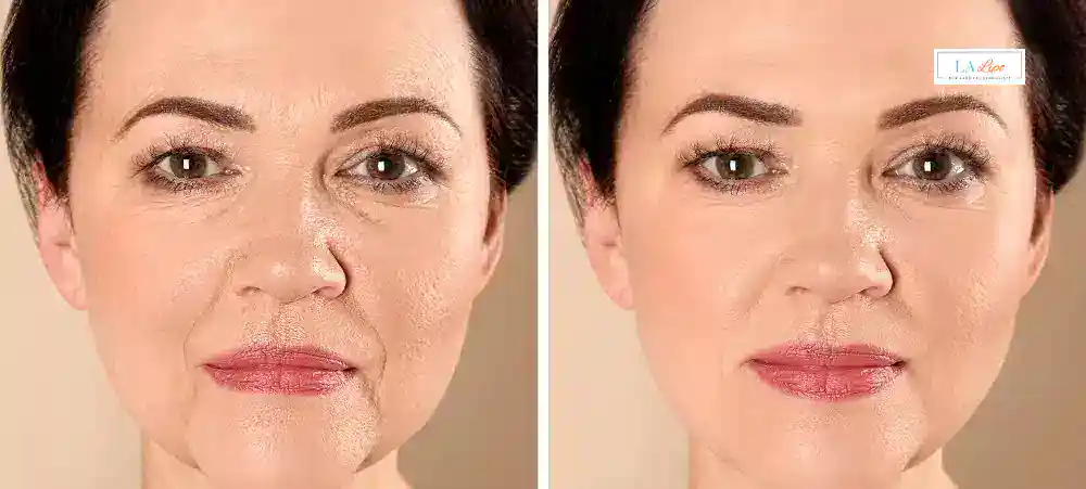 Why Aren’t My Skincare Products Making My Sagging Skin Look Firmer Sale?