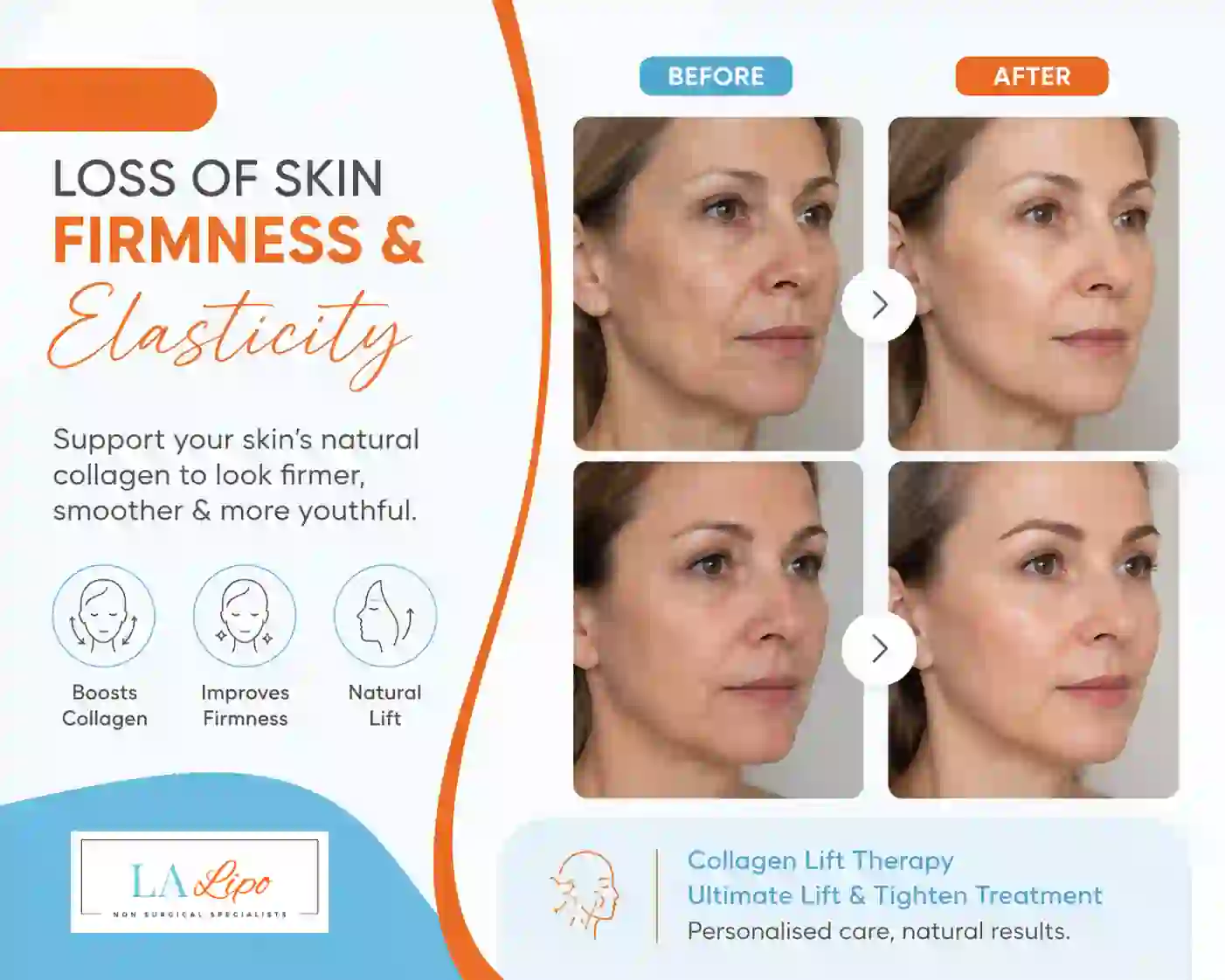 Sign #7: Loss of Skin Firmness and Elasticity Sale